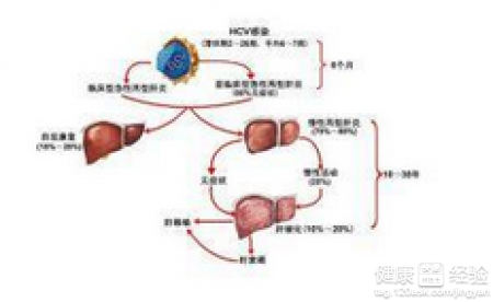 乙肝病毒五大傳播途徑