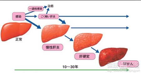 第2步