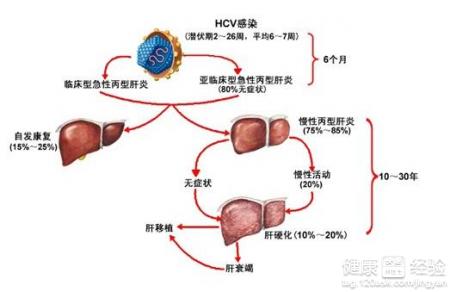 肝炎的主要症狀