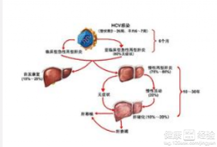 第3步