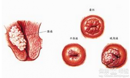 乙肝大三陽肝功能正常屬於活動期肝炎嗎