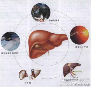 得了乙型肝炎抗原血症怎麼辦