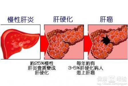 第3步