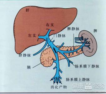 肝硬化是怎麼回事