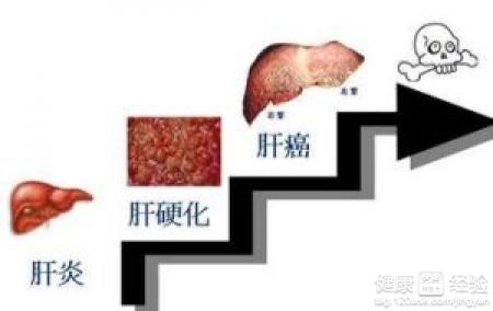 肝硬化腹水形成的因素有哪些