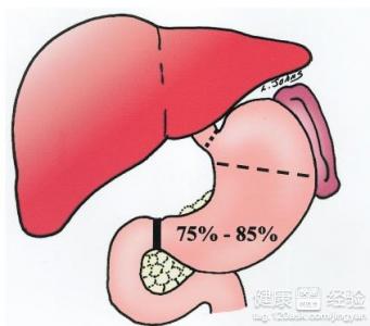 肝腹水的症狀是什麼