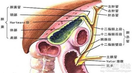 肝內膽管結石導致肝硬化如何救治