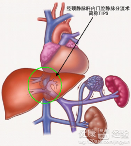 第2步