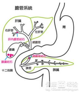 膽囊炎膽管炎能引起肝硬化嗎