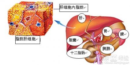 第1步