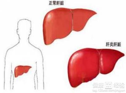 谷丙轉氨酶、谷草轉氨酶升高是什麼原因