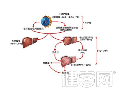 怎樣預防肝囊腫的發生