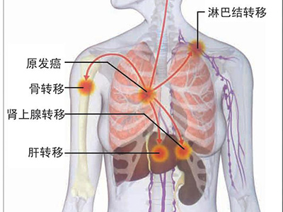 肝腹水患者一定要了解其檢查方法