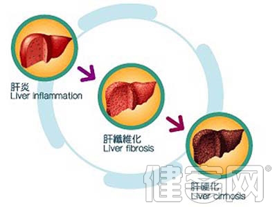 肝腹水的出現常預示5大損害