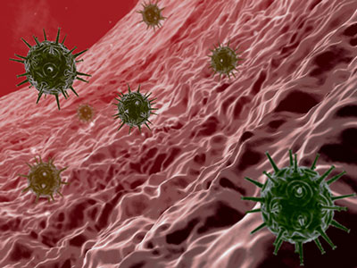 CDC低估了急性丙型肝炎病毒感染發病率