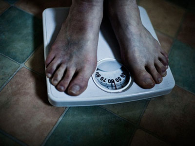 近1/5的中國非肥胖成年人患NAFLD！
