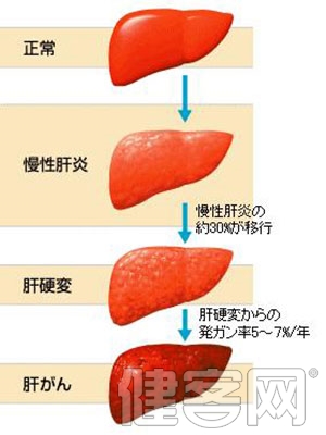 脂肪肝的危害和治療