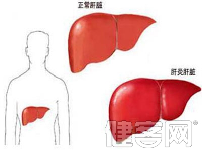 丙肝非常容易傳染給家人 丙肝都有哪些危害？