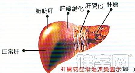 脂肪肝危害大 勤儉媽媽尤要當心