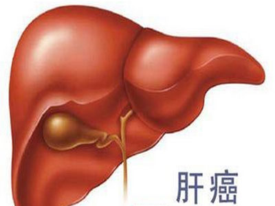 肝癌患者飲食搭配宜忌盤點