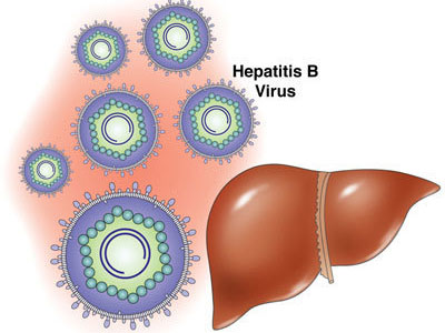 乙肝患者從三方面預防警惕癌變