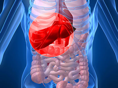 脂肪肝的形成原因是什麼呢