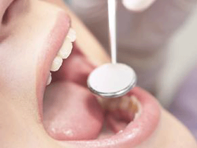 肝病患者需警惕牙龈出血