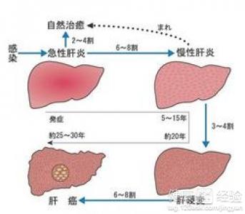 第1步