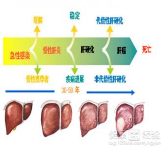 肝硬化腹水原因有什麼