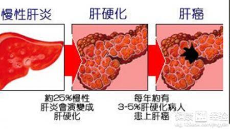 第1步