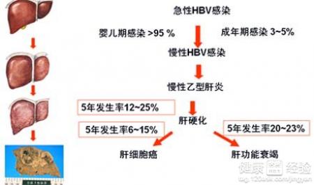 第1步