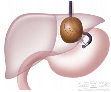 肝膿腫與肝囊腫的區別