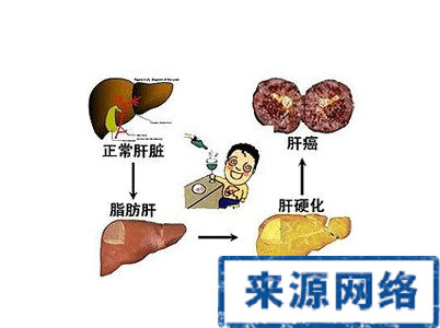 脂肪肝 脂肪肝飲食 脂肪肝營養原則